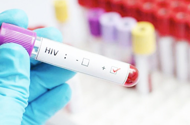 El 37% de pacientes con VIH en La Romana se encuentran en Abandono al Tratamiento