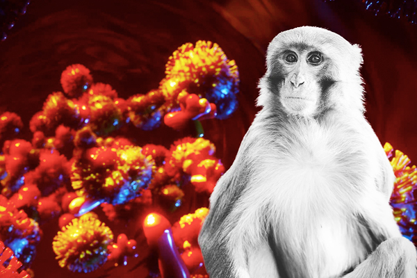 La Viruela del Mono: Lo que necesitas saber...